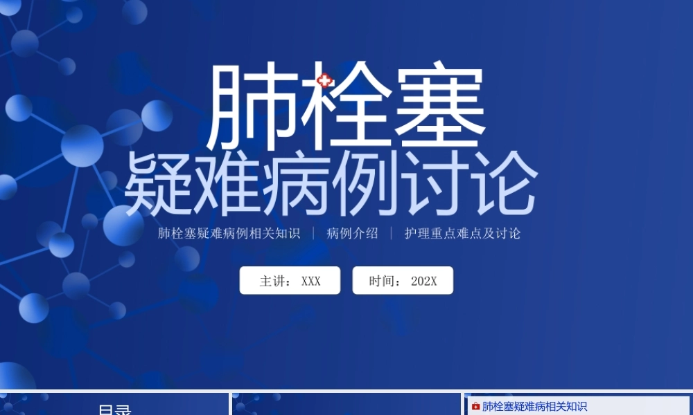 肺栓塞疑难病例相关知识介绍PPT肺栓塞病例介绍护理重点难点及讨论PPT课件（带内容）.pptx