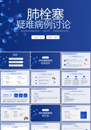 肺栓塞疑难病例相关知识介绍PPT肺栓塞病例介绍护理重点难点及讨论PPT课件（带内容）.pptx