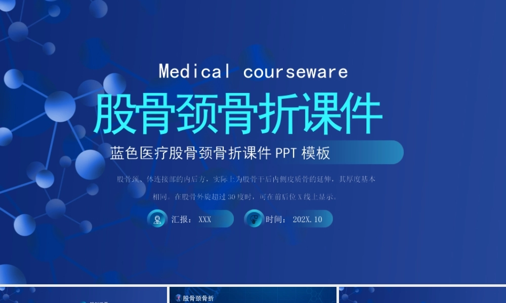股骨颈骨折临床表现与诊断鉴别诊断培训PPT课件（带内容）.pptx