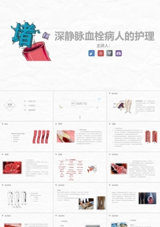 深静脉血栓病人的护理.pptx