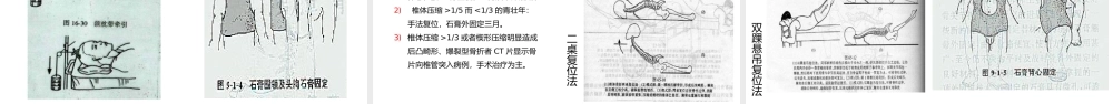 蓝色卡通风脊柱骨折与脊髓损伤.pptx