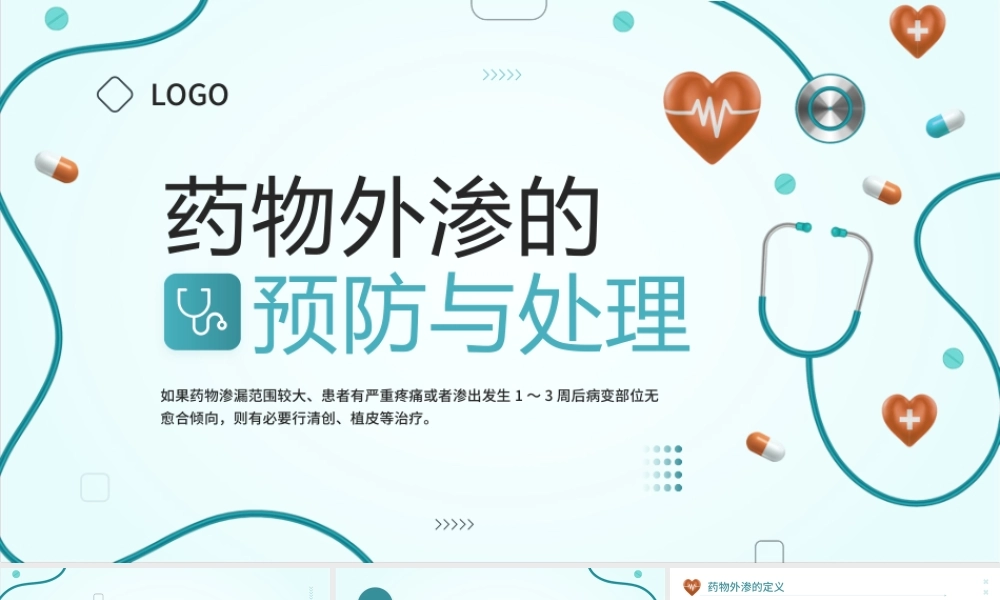 药物外渗的预防与处理培训课件.pptx
