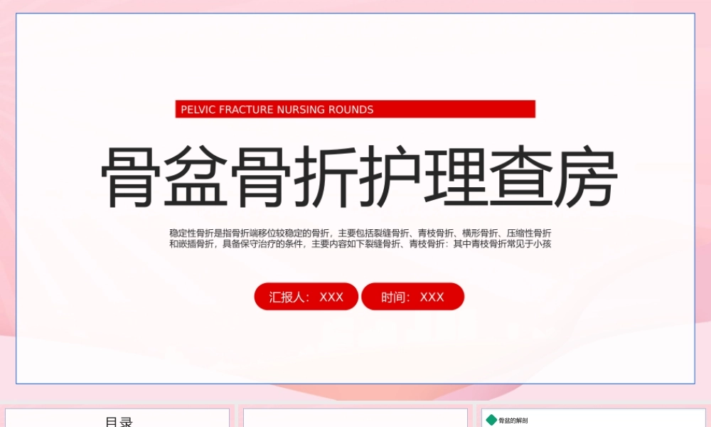 骨盆骨折护理查房PPT骨盆骨折的临床表现治疗方法PPT课件（带内容）.pptx