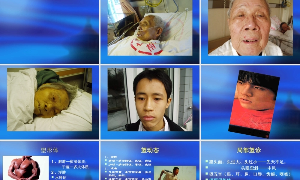 中医四诊教学课件.pptx