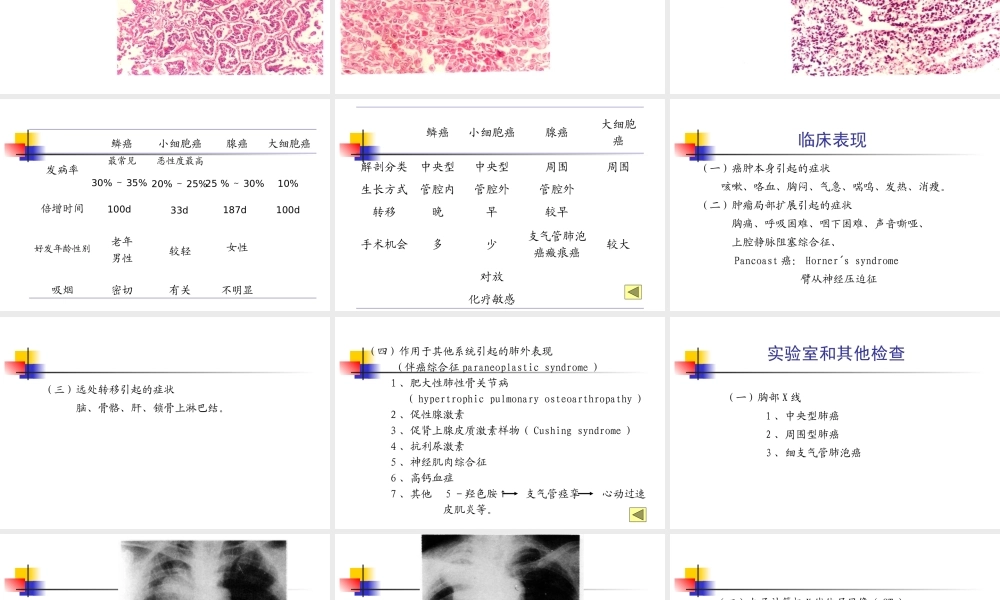 呼吸系统疾病原发性支气管肺癌医学教学课件.pptx