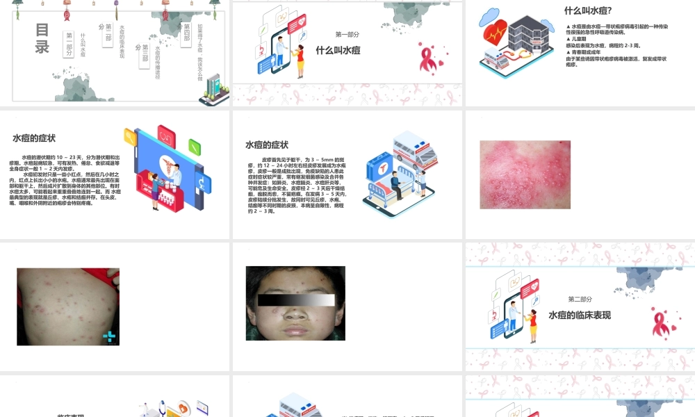 预防水痘主题班会PPT课件（带内容）.pptx