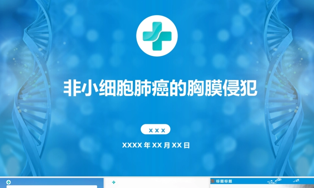 非小细胞肺癌的胸膜侵犯医学课件PPT课件（带内容）.pptx