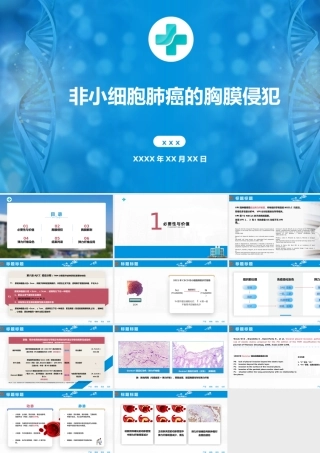 非小细胞肺癌的胸膜侵犯医学课件PPT课件（带内容）.pptx
