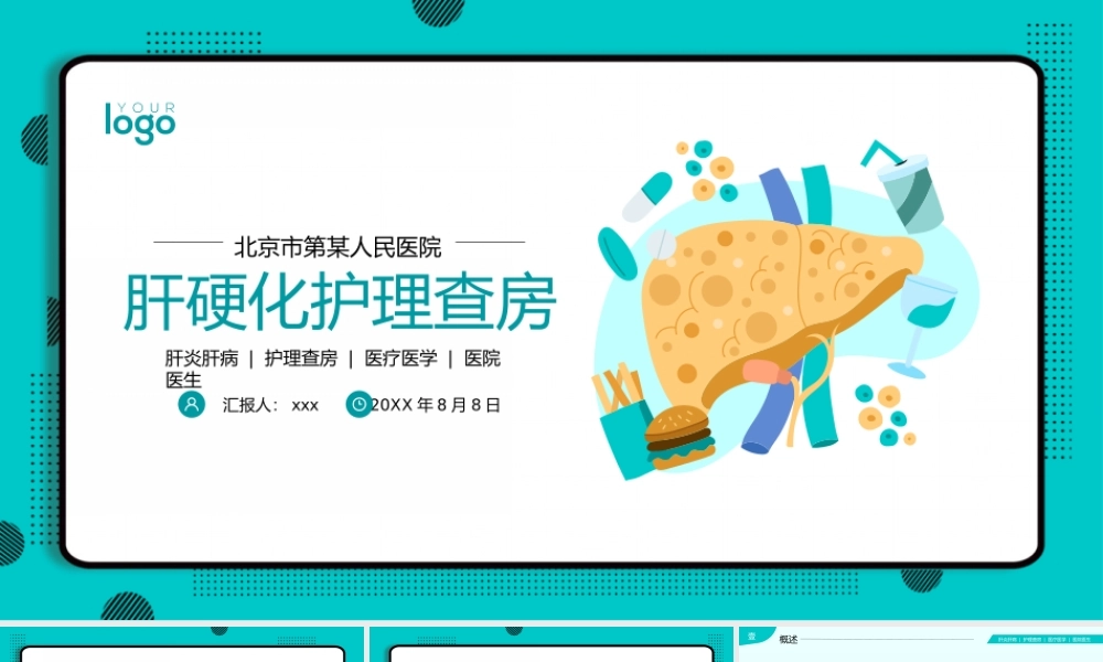 肝病肝硬化护理查房医疗PPT模板(含具体内容).pptx