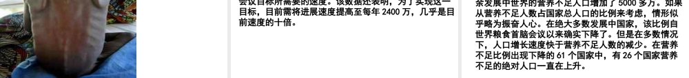 世界儿童.ppt