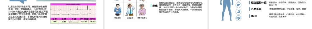 2022急性心肌梗死医疗护理查房PPT课件（带内容）.ppt