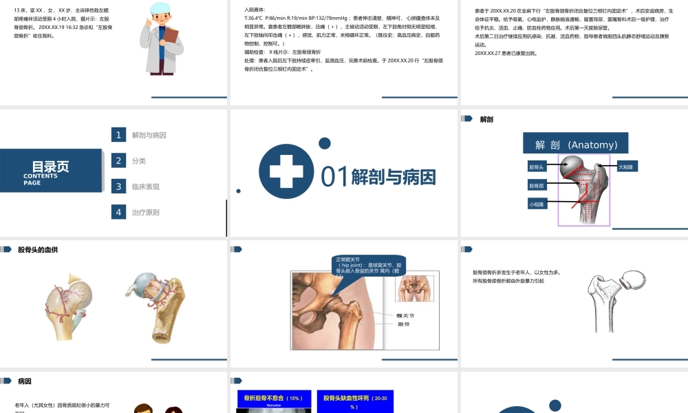 2022股骨颈骨折的护理培训PPT课件（带内容）.ppt