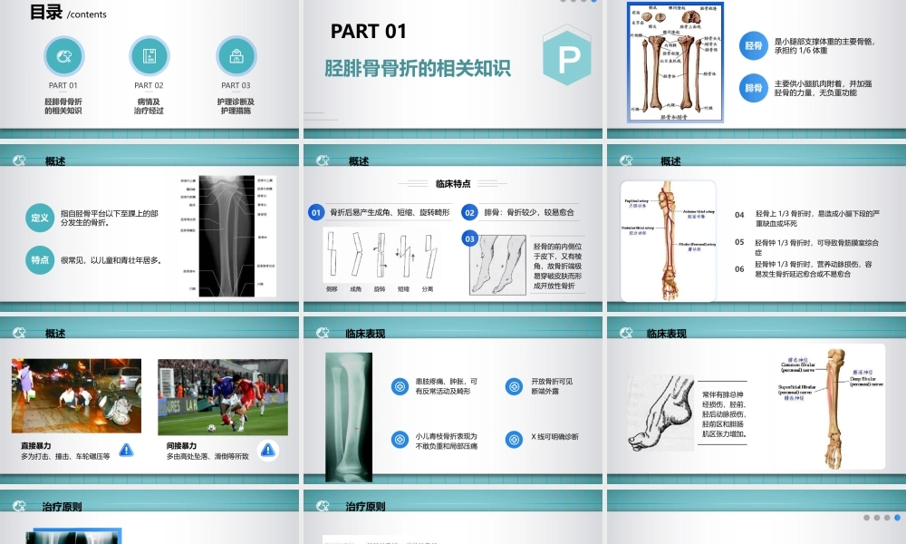 2022胫腓骨骨折护理培训PPT课件（带内容）.pptx