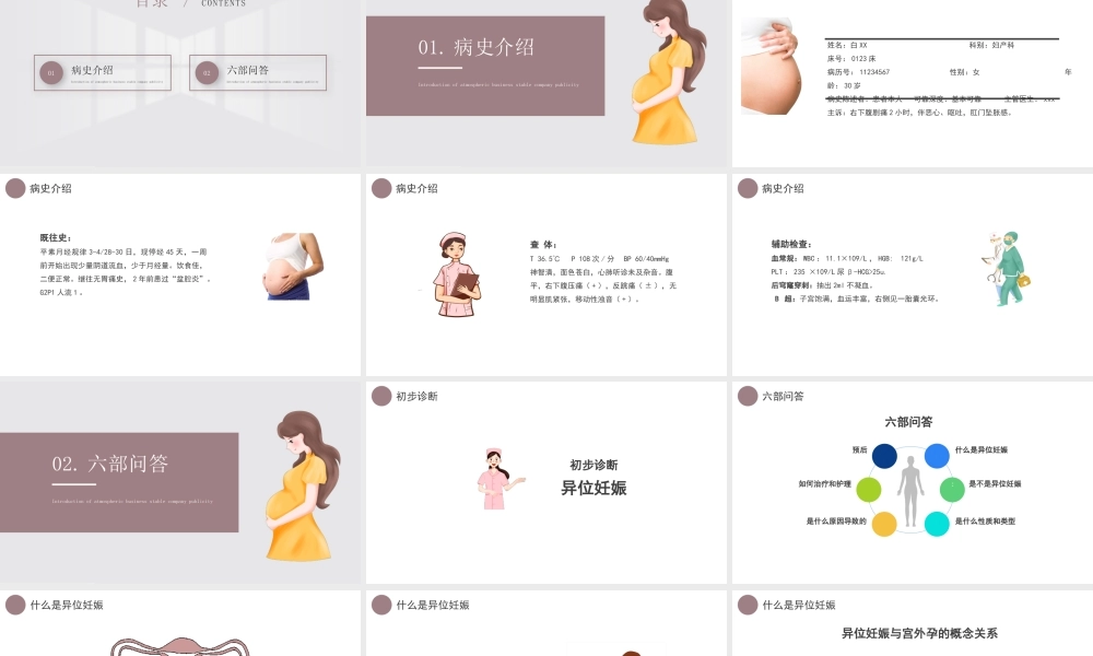 2022异位妊娠护理培训PPT课件（带内容）.pptx