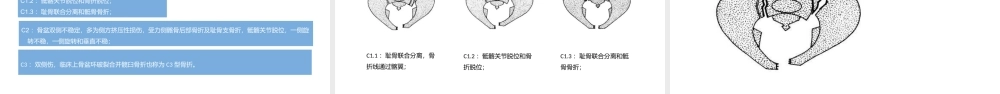 2022骨盆骨折护理查房培训PPT课件（带内容）.ppt
