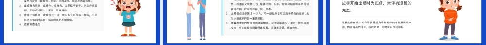2022水痘预防知识科普PPT课件（带内容）.pptx
