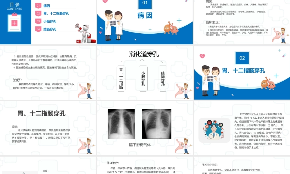 2022消化道穿孔医疗课件知识PPT课件（带内容）.ppt