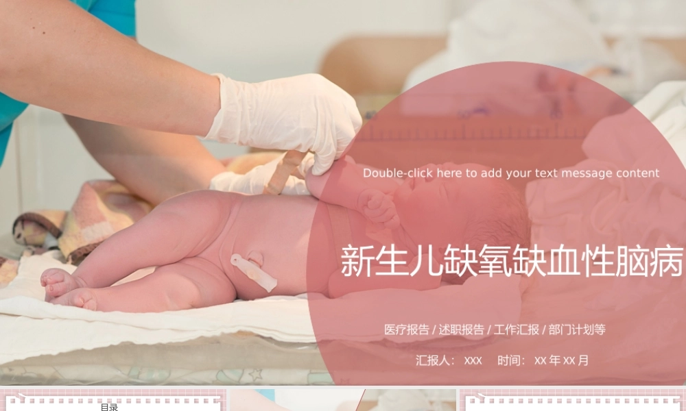 2022新生儿缺氧缺血性脑病护理查房PPT课件（带内容）.pptx