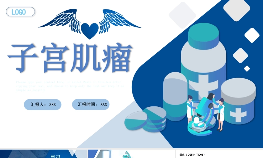 2022子宫肌瘤治疗与护理PPT课件（带内容）.pptx