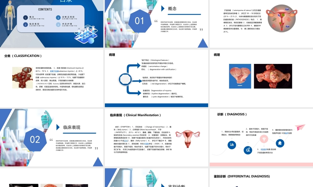 2022子宫肌瘤治疗与护理PPT课件（带内容）.pptx