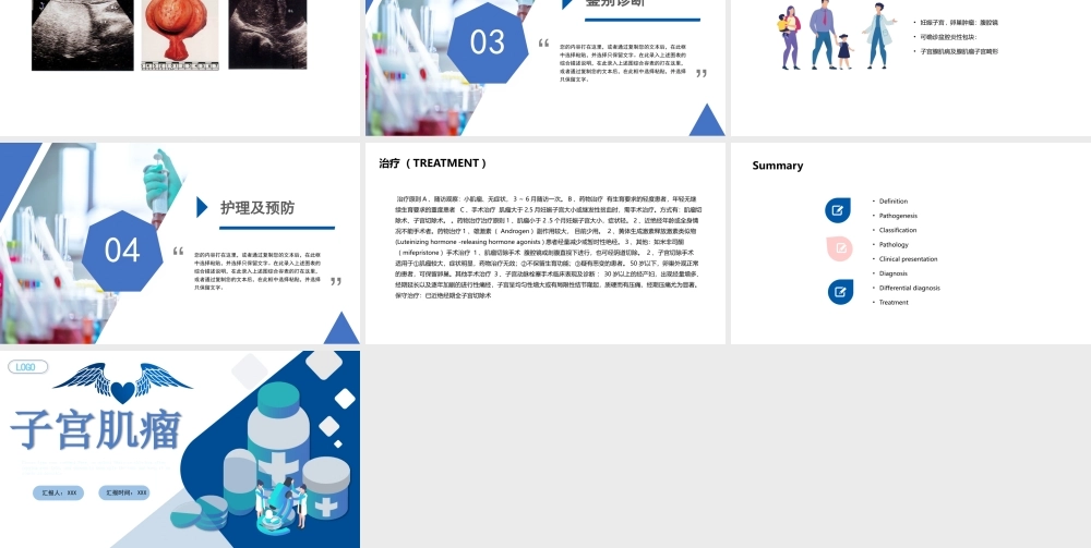2022子宫肌瘤治疗与护理PPT课件（带内容）.pptx
