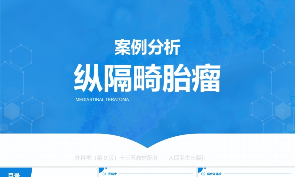 外科学（第9版）十三五教材——纵隔畸胎瘤案例分析PPT课件（带内容）.pptx