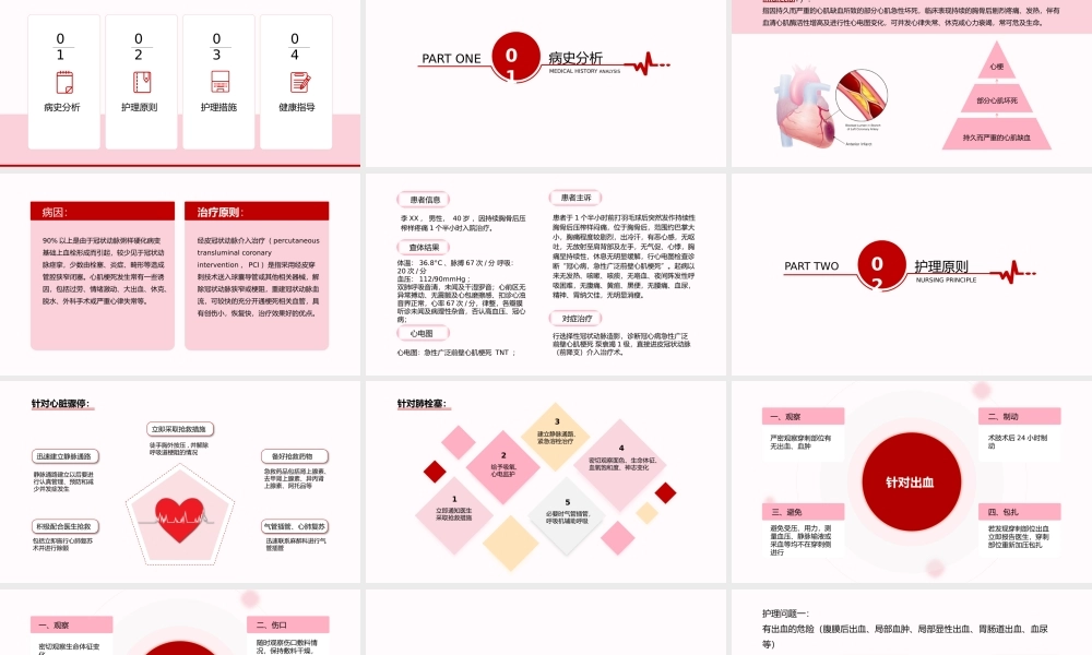 急性心梗护理查房及案例分析PPT课件（带内容）.pptx