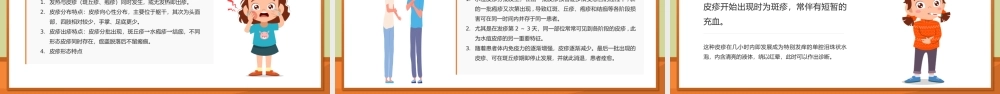 中小学幼儿园水痘预防知识科普PPT模板.pptx