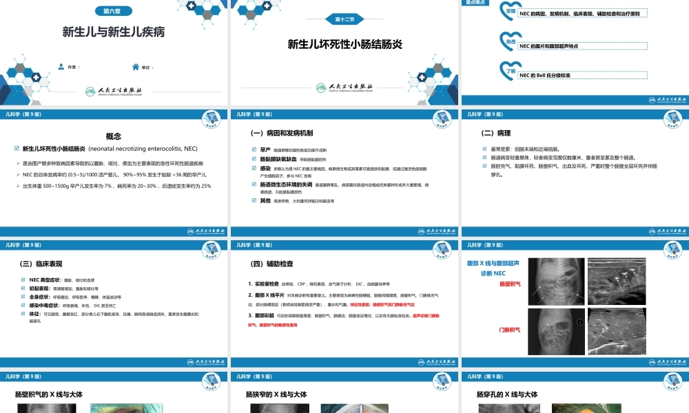 第六章 新生儿与新生儿疾病 第十二节 新生儿坏死性小肠结肠炎.pptx