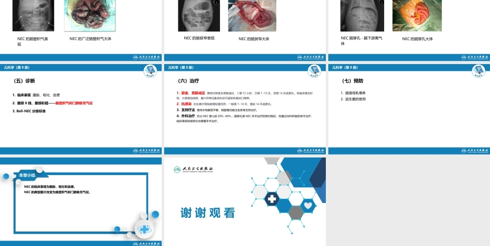 第六章 新生儿与新生儿疾病 第十二节 新生儿坏死性小肠结肠炎.pptx