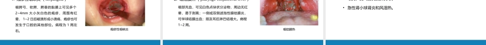 第十章 呼吸系统疾病 第一节-第五节.pptx