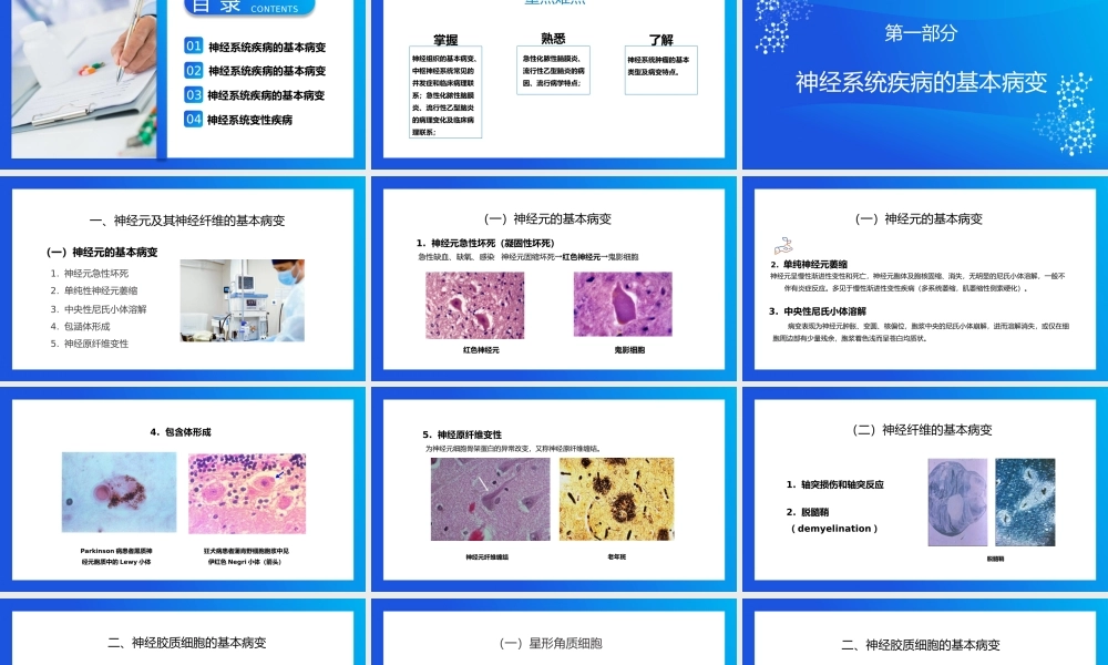 医学病理神经系统疾病PPT模板.pptx
