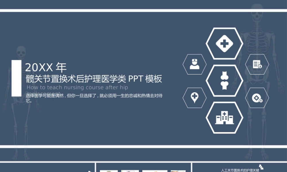 髋关节置换术后护理医学类PPT课件（带内容）.pptx