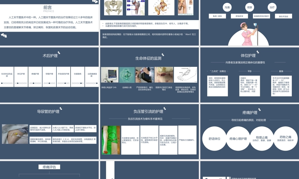 髋关节置换术后护理医学类PPT课件（带内容）.pptx