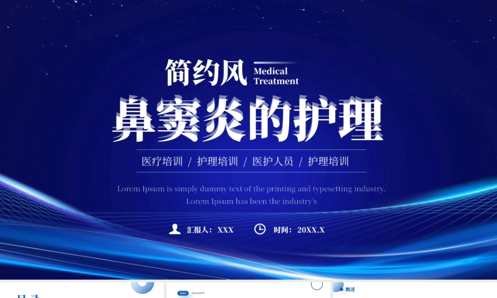 鼻窦炎的护理评估及诊断病因和临床表现.pptx